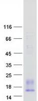 Human PF4V1 Protein (Recombinant Myc-DDK (Flag))