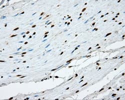 APP / Beta Amyloid Precursor Antibody (clone OTI2B10)