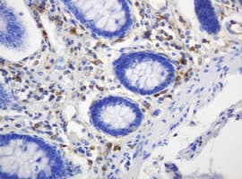 TP / Thymidine Phosphorylase Antibody (aa311-482, clone 7A6, Carrier-free)