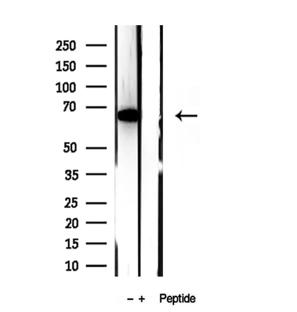 Polyclonal Rabbit anti-Human METTL3 Antibody (IHC, WB)