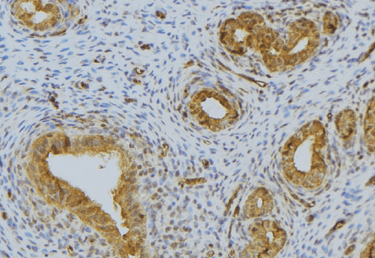 RNASE12 Antibody