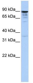 MCTP1 Antibody (C-Terminus)