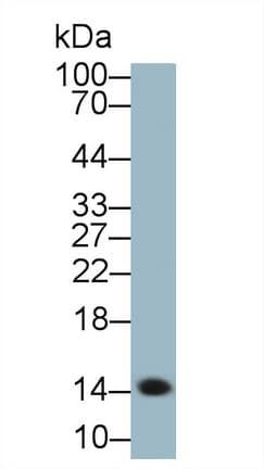 Serum Amyloid A Antibody (aa19-122, PE)