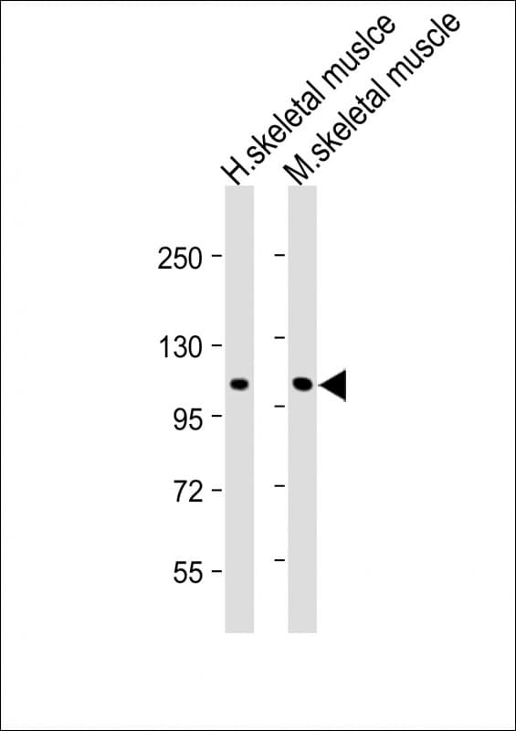 CLCN1 / CLC-1 Antibody (N-Terminus)