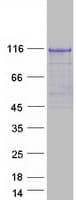 Human TUT1 Protein (Recombinant Myc-DDK (Flag))