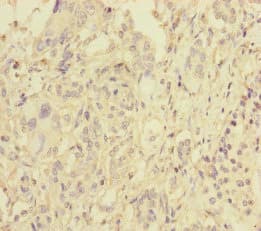 PLDN / Pallidin Antibody