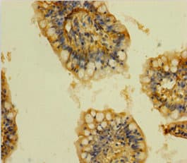 CLTB Antibody