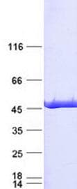 Human IDH1 / IDH Protein (Recombinant Myc-DDK (Flag), C-terminus)