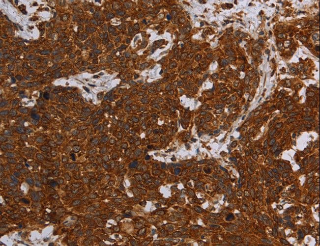 ERRFI1 / RALT Antibody