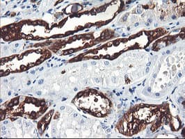 PFKP Antibody (clone OTI2E8, Carrier-free)