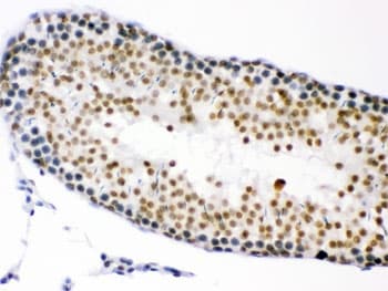 CDK1 / CDC2 Antibody