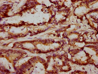 Polyclonal Rabbit anti-Human FRMD6 Antibody (IHC)