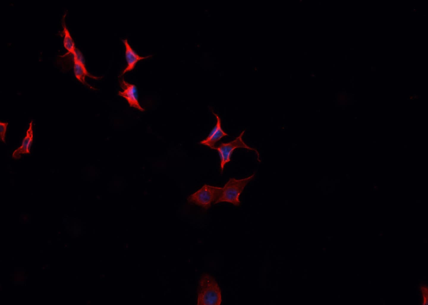 C2orf40 / ECRG4 Antibody