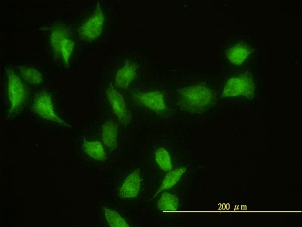 IHC-plus™ GIT2 Antibody (clone 3B5-B9)