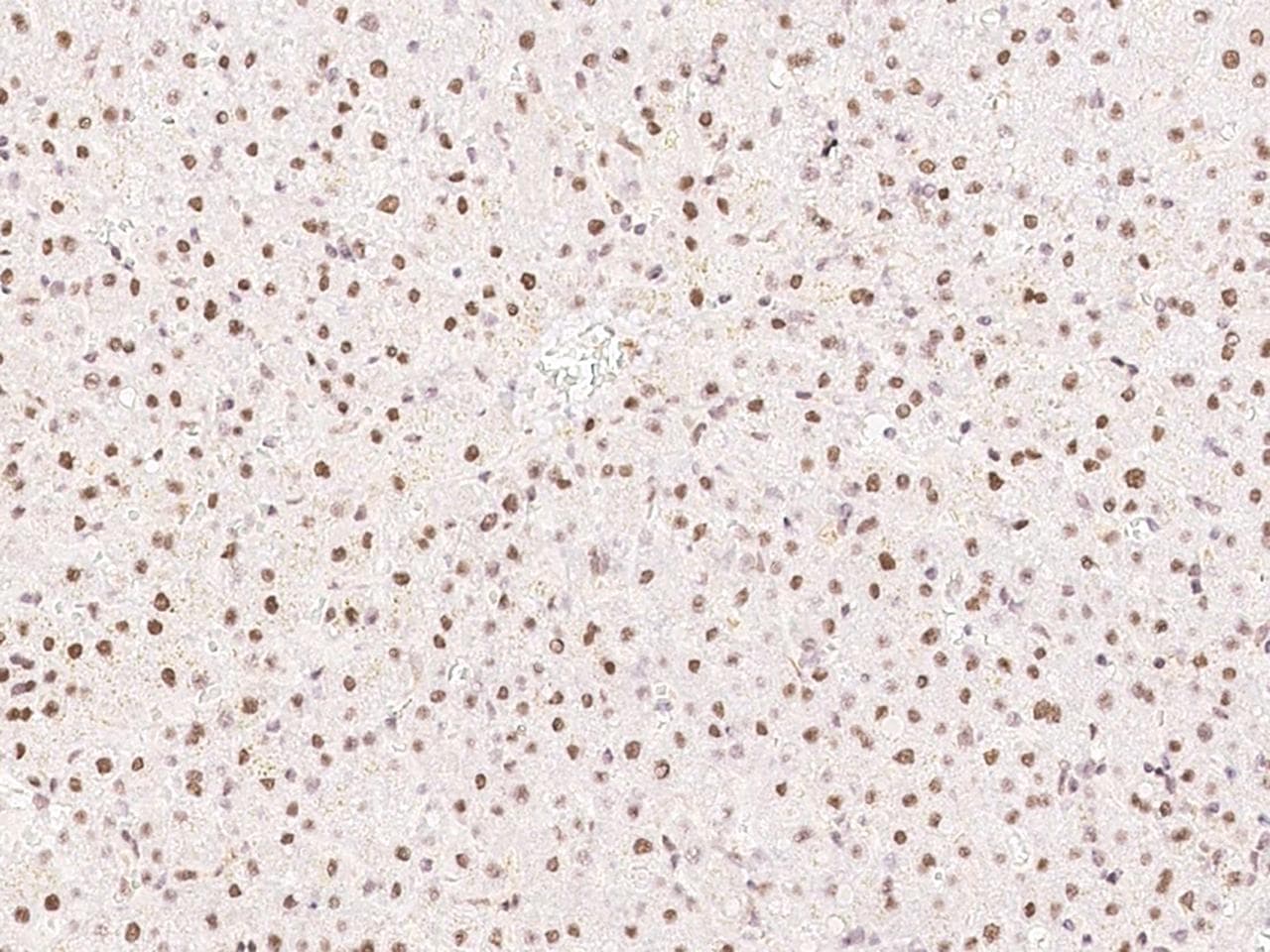 PHTF2 Antibody