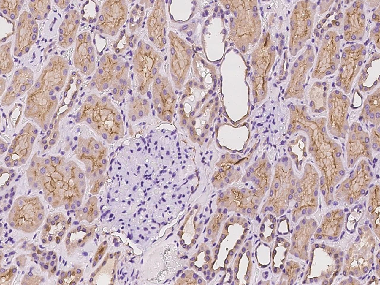 SUSD2 Antibody