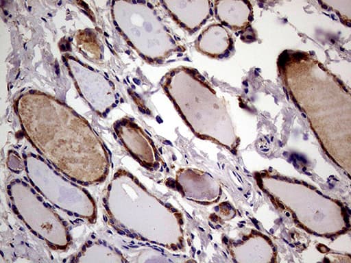 RRBP1 / hES Antibody (aa484-590, clone OTI3F1)