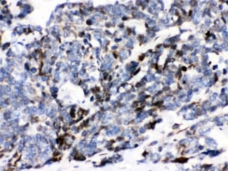 ATXN1 / SCA1 Antibody