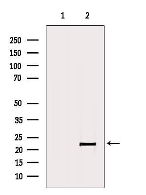 C11orf73 Antibody