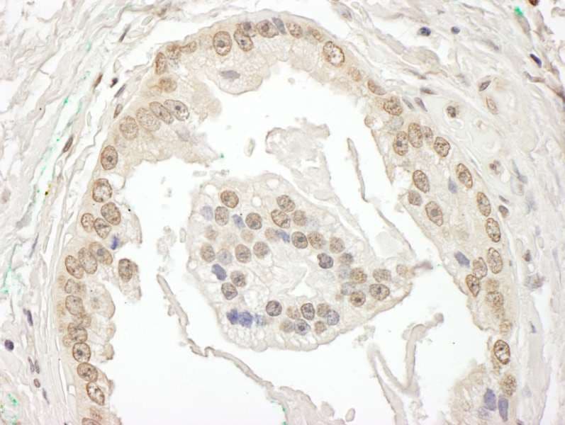 Polyclonal Rabbit anti-Human BRD7 Antibody (aa601-651, IHC, WB)