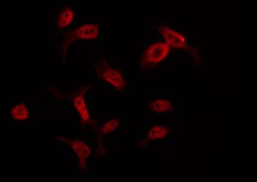MSY2 / YBX2 Antibody