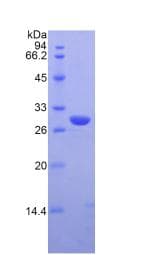 Mouse IRAK2 / IRAK-2 Protein (Recombinant His)