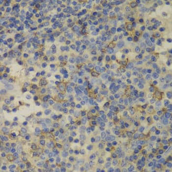 FTL / Ferritin Light Chain Antibody