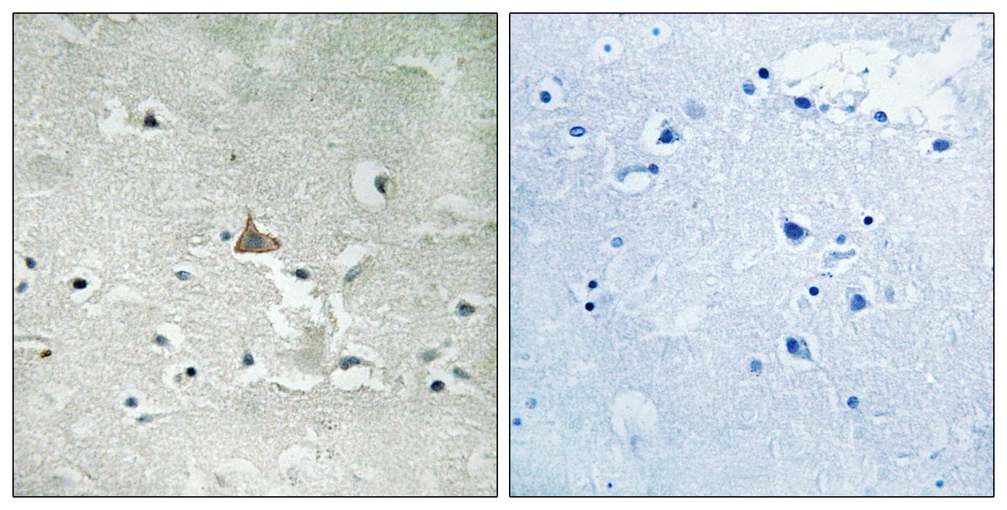 NTRK2 / TRKB Antibody (phospho-Tyr706+Tyr707)