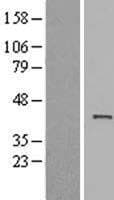 ACTRT1 Protein (Over-Expression Lysate Myc-DDK (Flag))