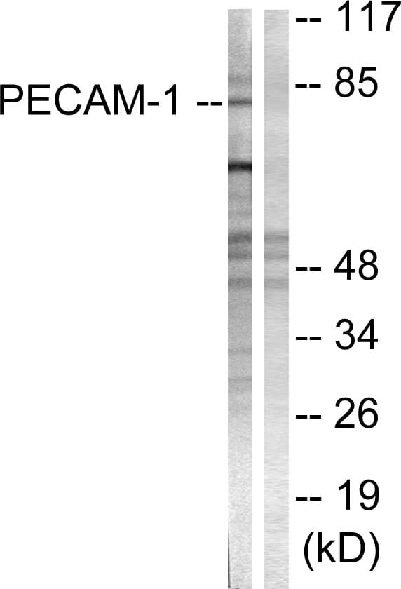 IHC-plus™ PECAM-1 / CD31 Antibody (aa686-735)