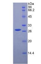 Mouse HGF / Hepatocyte Growth Factor Protein (Recombinant His)