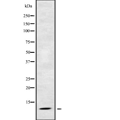 Polyclonal Rabbit anti-Human RPS21 / Ribosomal Protein S21 Antibody (WB)