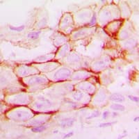 MMP14 Antibody (C-Terminus)
