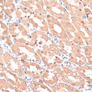 Polyclonal Rabbit anti-Human HMGIY / HMGA1 Antibody (IHC, IF, WB)