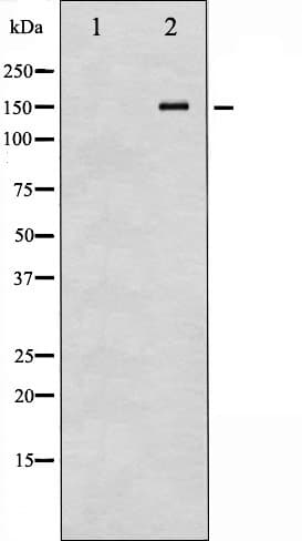 PDGFRA / PDGFR Alpha Antibody (phospho-Tyr849)