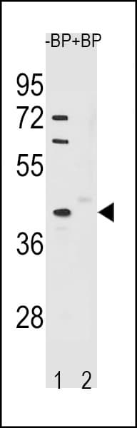 Polyclonal Rabbit anti-Human STK25 Antibody (aa347-375, WB)