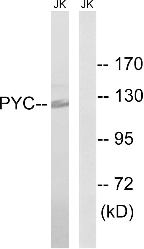 PC / Pyruvate Carboxylase Antibody (aa357-406)