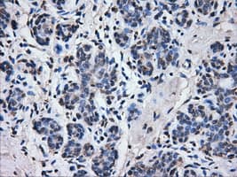 ATP5B / ATP Synthase Beta Antibody (clone OTI6C4)