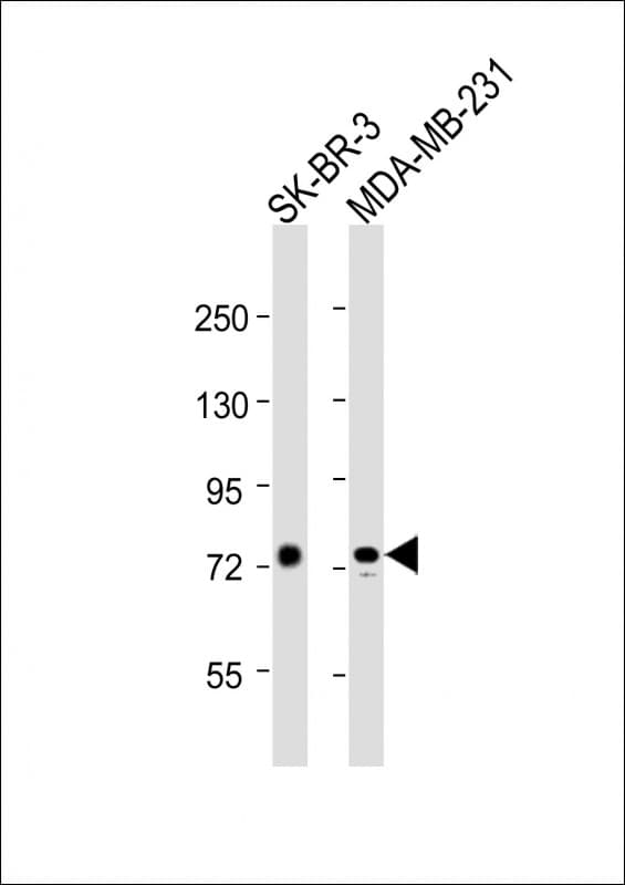 YY1AP1 Antibody (aa138-168)