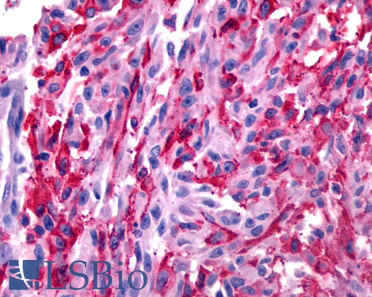 PathPlus™ Polyclonal Rabbit anti-Human GALR2 / Galanin Receptor 2 Antibody (Transmembrane Domain, IHC)