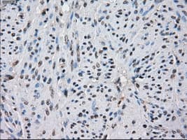 IDH1 / IDH Antibody (clone OTI2H9)