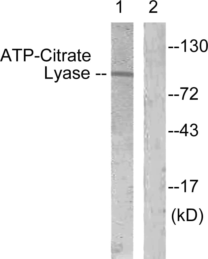 ACLY / ATP Citrate Lyase Antibody (aa420-469)