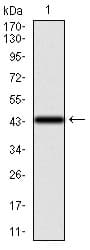 IHC-plus™ KRT13 / CK13 / Cytokeratin 13 Antibody (clone 3G4)
