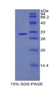 Mouse IL17RA Protein (Recombinant His)