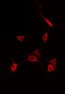 Polyclonal Rabbit anti-Human EIF2AK1 Antibody (IF, WB)