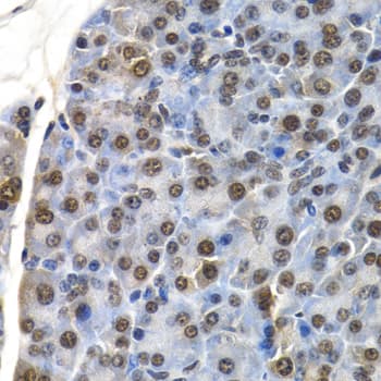 Polyclonal Rabbit anti-Human ID3 Antibody (IHC, IF, WB)