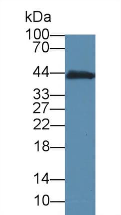 CKM / Creatine Kinase MM Antibody (Biotin)