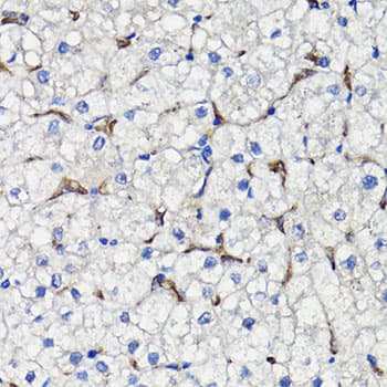 COMP / THBS5 Antibody