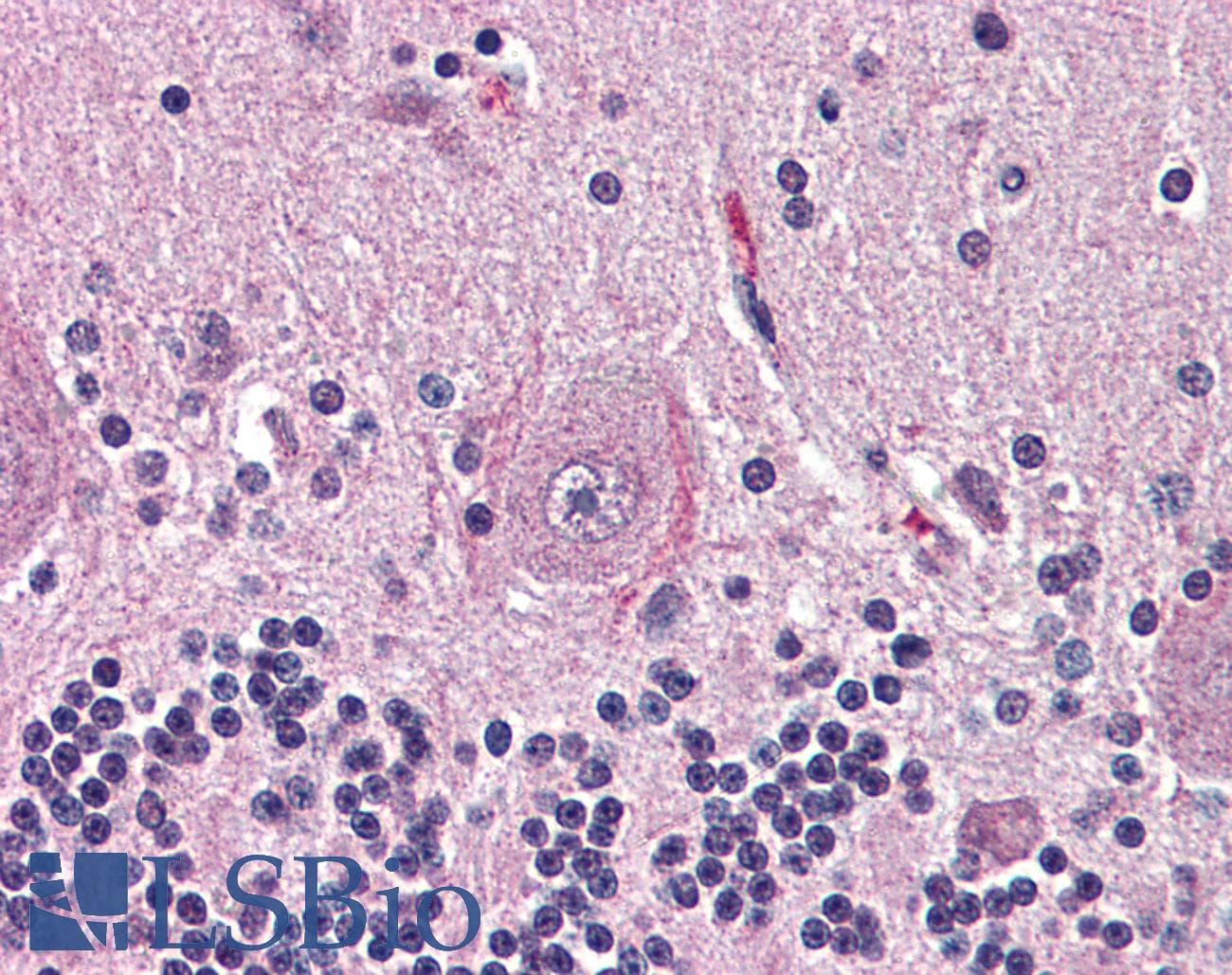 IHC-plus™ Polyclonal Rabbit anti-Human NTSR2 / NTR2 Antibody (Internal, IHC)
