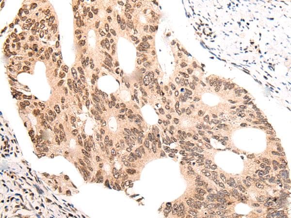 Polyclonal Rabbit anti-Human KNOP1 / C16orf88 Antibody (IHC)
